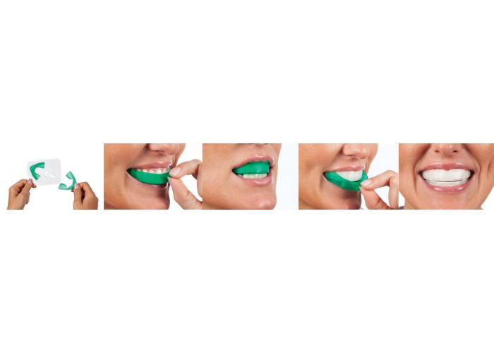 Ultradent - λευκανση - δοντια - Opalescence Go 6% Melon - Λεύκανση δοντιών για το σπίτι  Opalescence Go - Λεύκανση δοντιών για το σπίτι